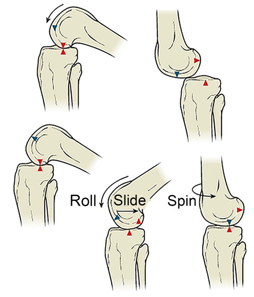Everything designed to move has a built-in factor of “play” to promote efficient functional movement. For example, an automobile pis­ton and cylinder, a wheel on an axle, and even a simple hinge all have calculated play between their moving parts to allow efficiency of movement. Why not in a human joint? (Fig 1)