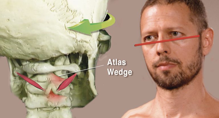 Figure 3. Teleceptor function activates reflexes that trigger muscle spasm and alter spinal joint motion
