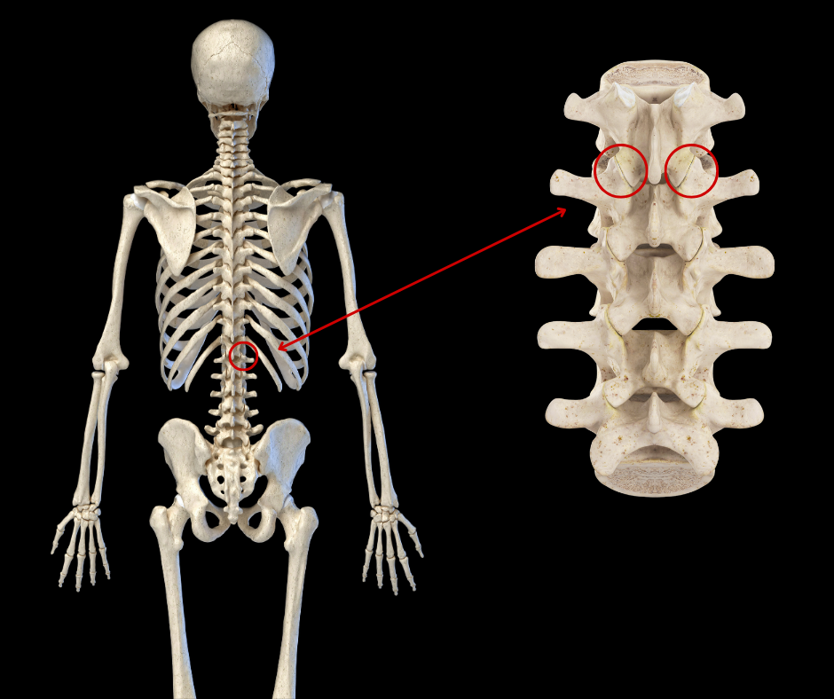 Diagram of zygapophyseal joints showing superior and inferior articular processes forming paired synovial joints in the lumbar spine