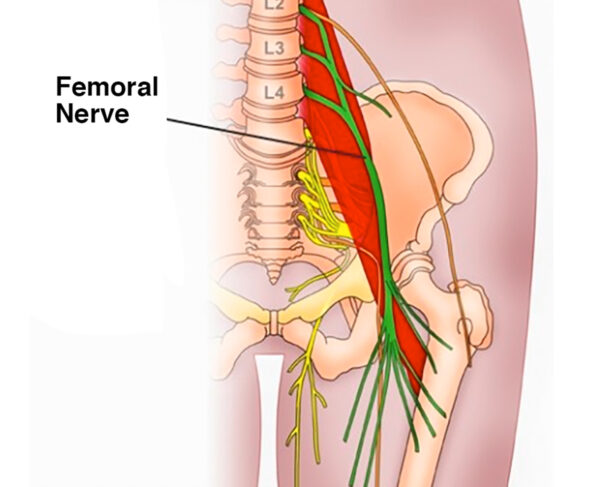 FemoralNerve