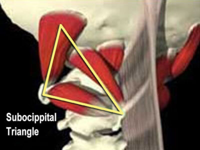 Suboccippital muscles with nerves removed